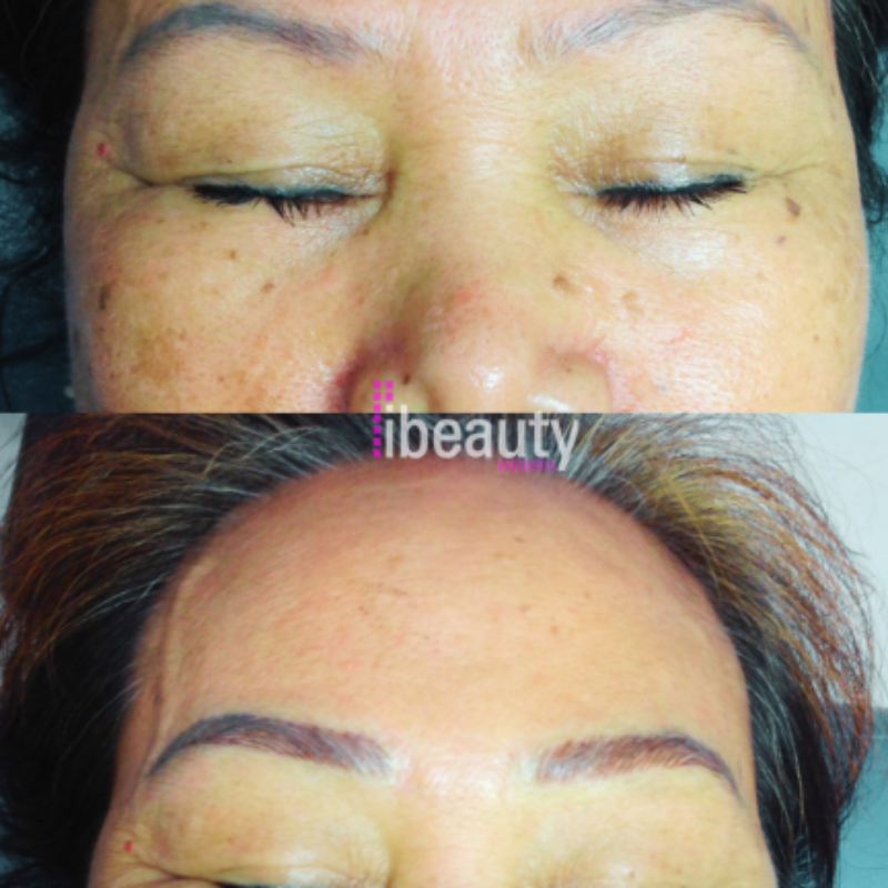 eyebrow before after 10