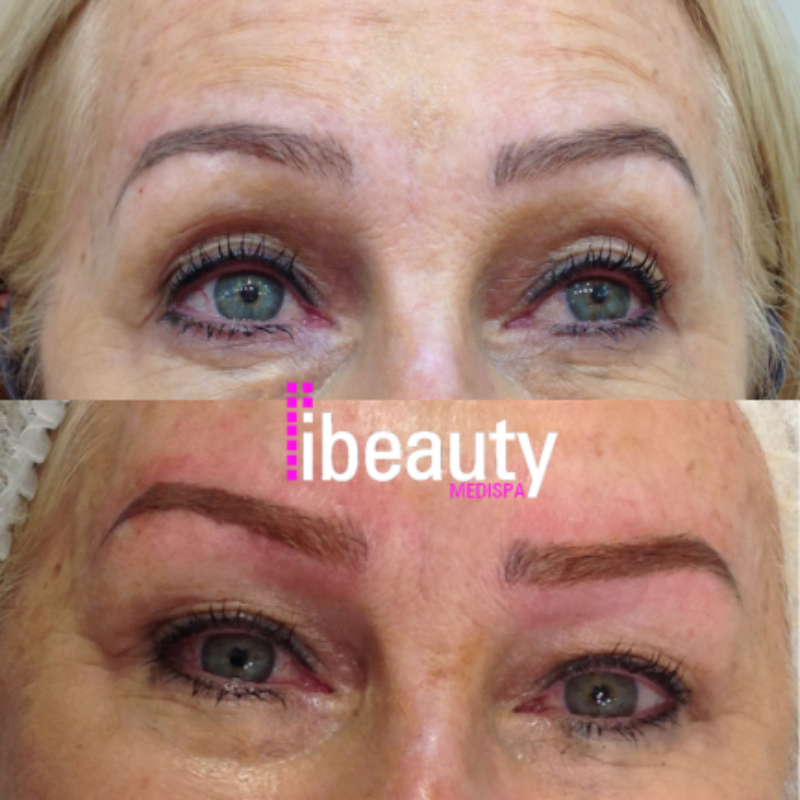 eyebrow before after 3