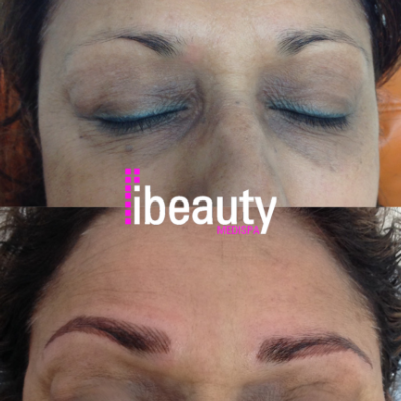 eyebrow before after 7