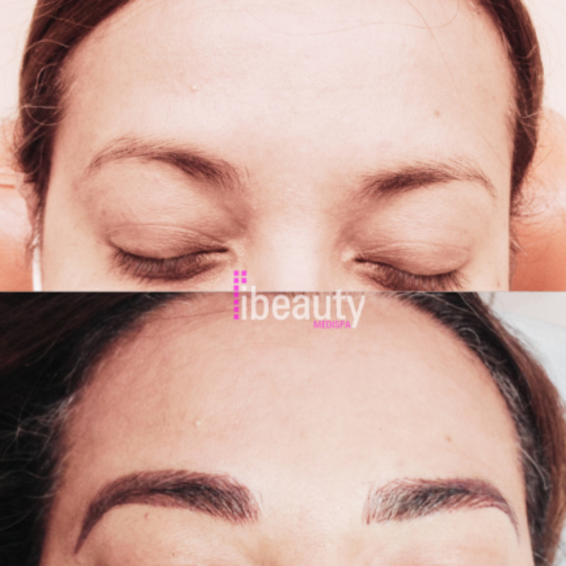 eyebrow before after 9